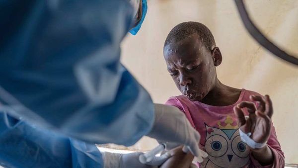 Congo Finally Begins Mpox Vaccinations in Drive to Slow Outbreaks Declared a Global Emergency