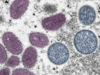 SF mpox cases rising, most cases among those vaxxed