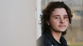 California Protester Left Blind in One Eye Is Among String of Violent Run-ins With Federal Agents