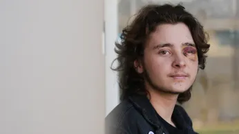 California Protester Left Blind in One Eye Is Among String of Violent Run-ins With Federal Agents